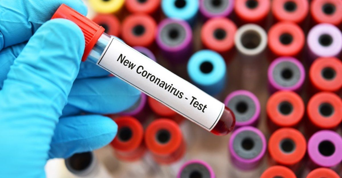 Coronavirüs Panzehiri